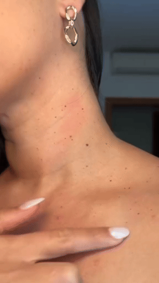 Elimina verrugas Tag recede Premium